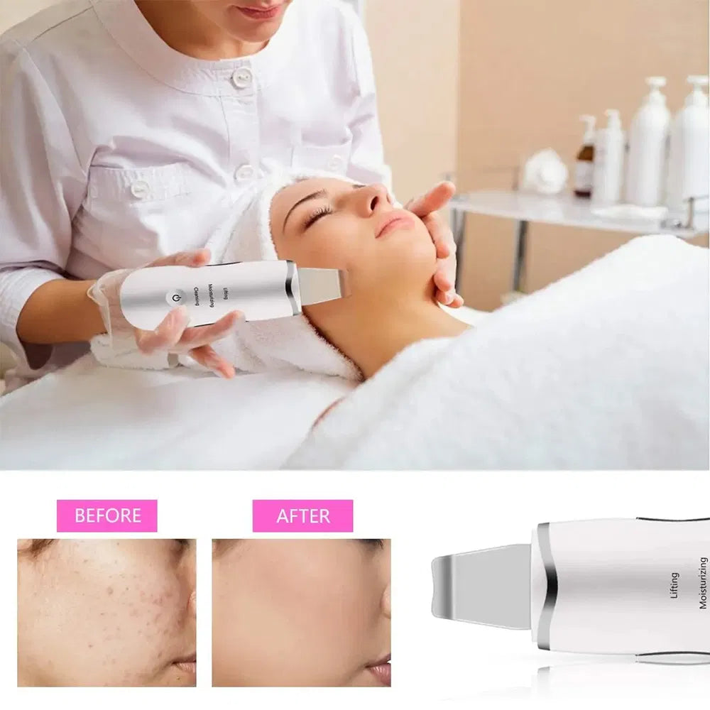 PoreGlow Ultrasonic Skin Scrubber for Deep Facial Cleansing